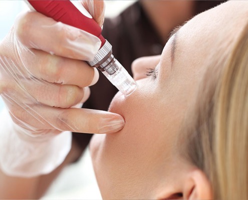 Mesotherapie Behandlung