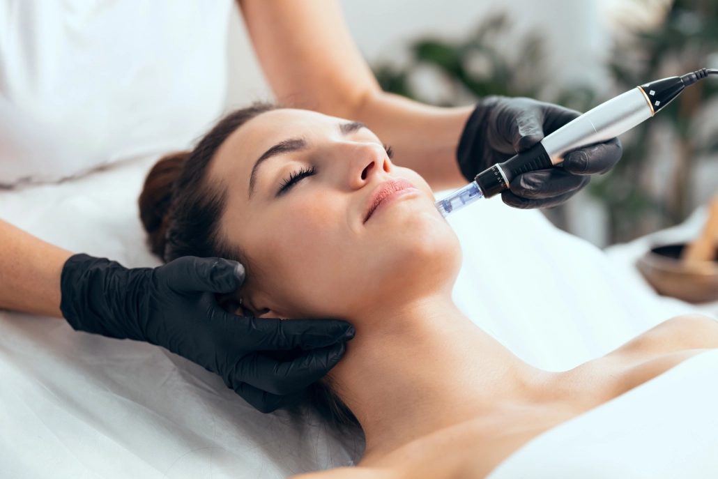 Microneedling – Kollagenstimulation zur Hautverbesserung Behandlerin in schwarzen Handschuhen führt Microneedling im Wangenbereich einer liegenden Patientin durch